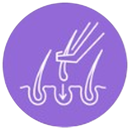 Haartransplantation